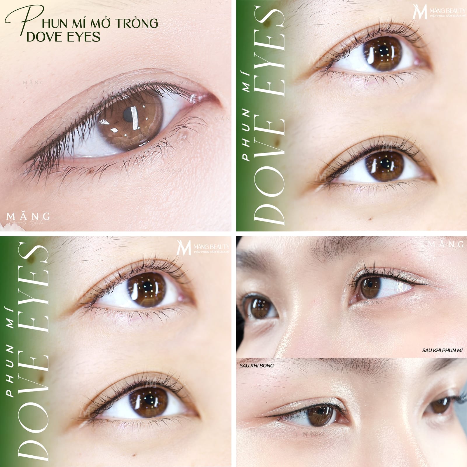 Hình ảnh thực tế khách hàng sau khi thực hiện phun mí mở tròng tại Măng Beauty