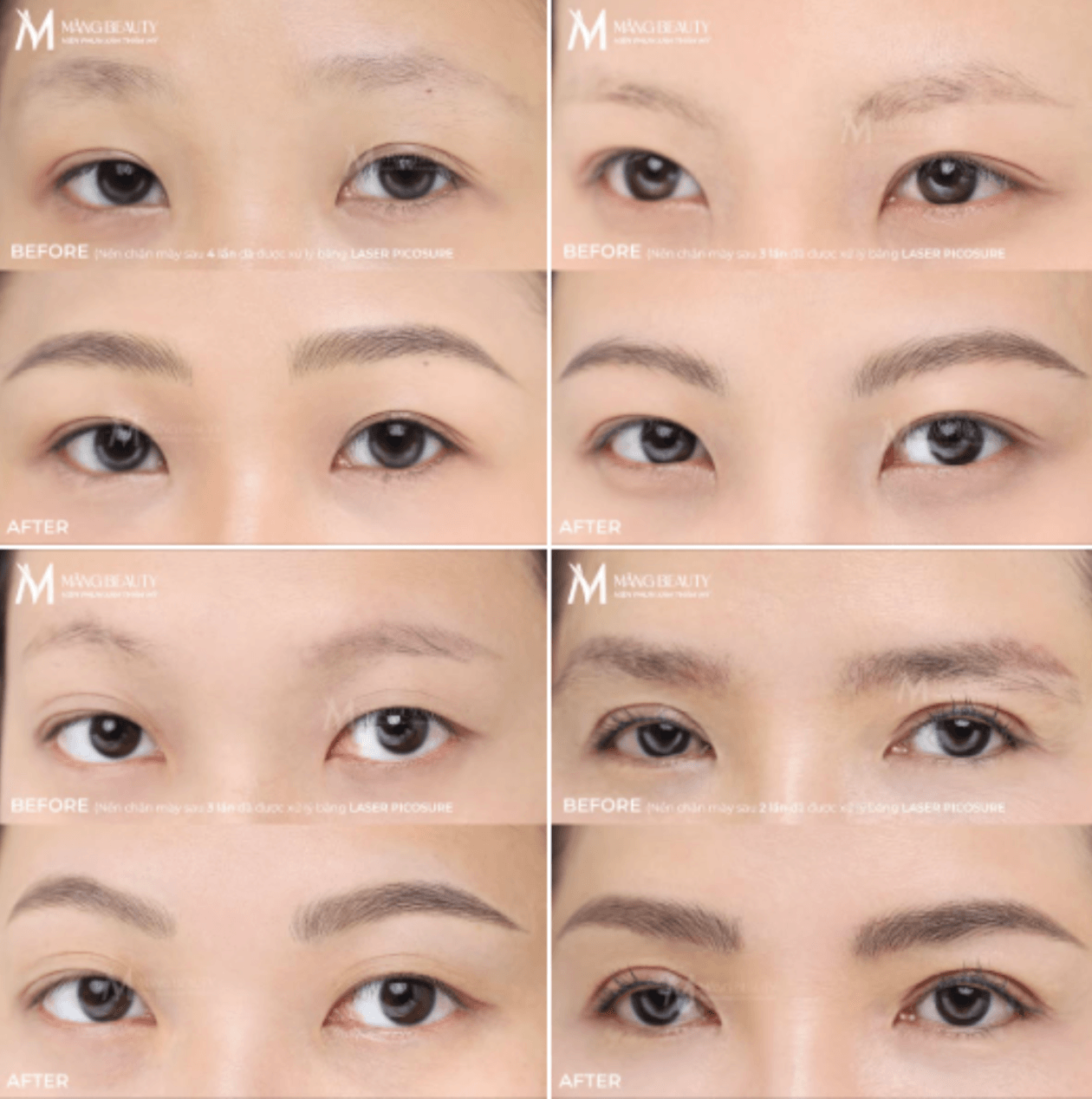 Hình ảnh thực tế tác phẩm chân mày sợi Magic Brows tại Măng Beauty