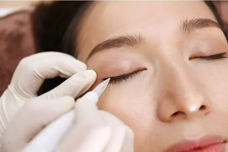Phun mí đá đuôi - phương pháp làm đẹp đang được nhiều người ưa chuộng