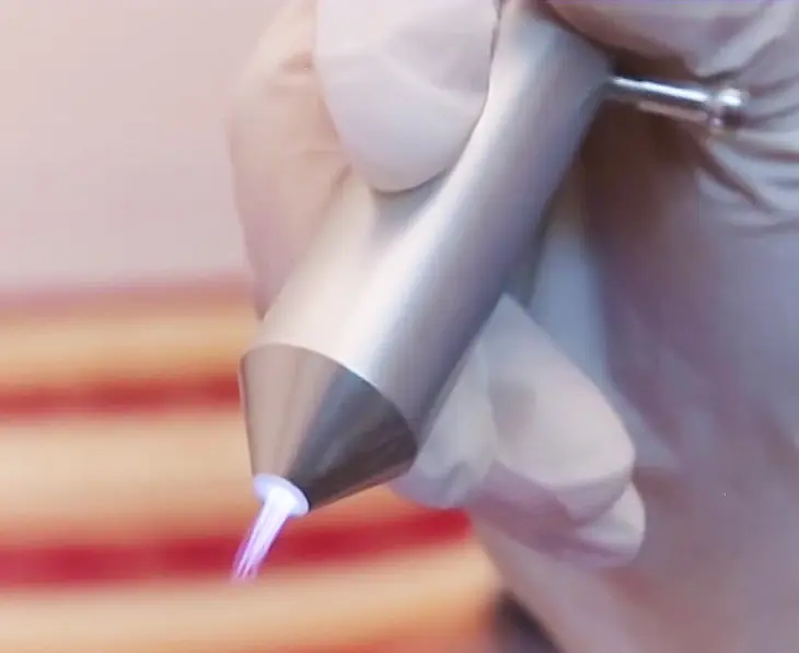 Chiếu tia Plasma là gì?