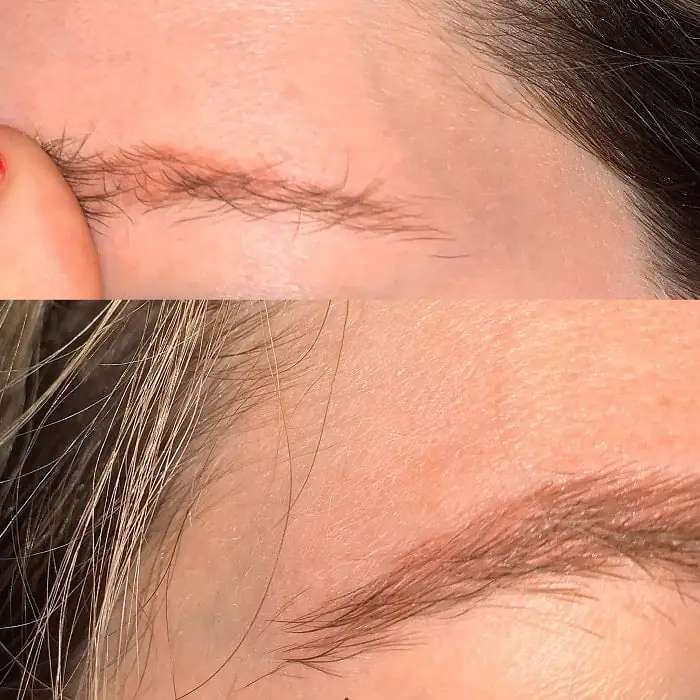 Chân mày xăm bị trổ đỏ