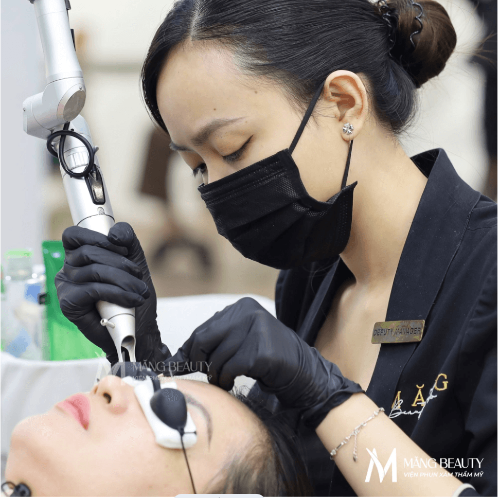 Xóa chân mày bằng Laser Picosure Pro là phương pháp hiện đại và hiệu quả nhất hiện nay