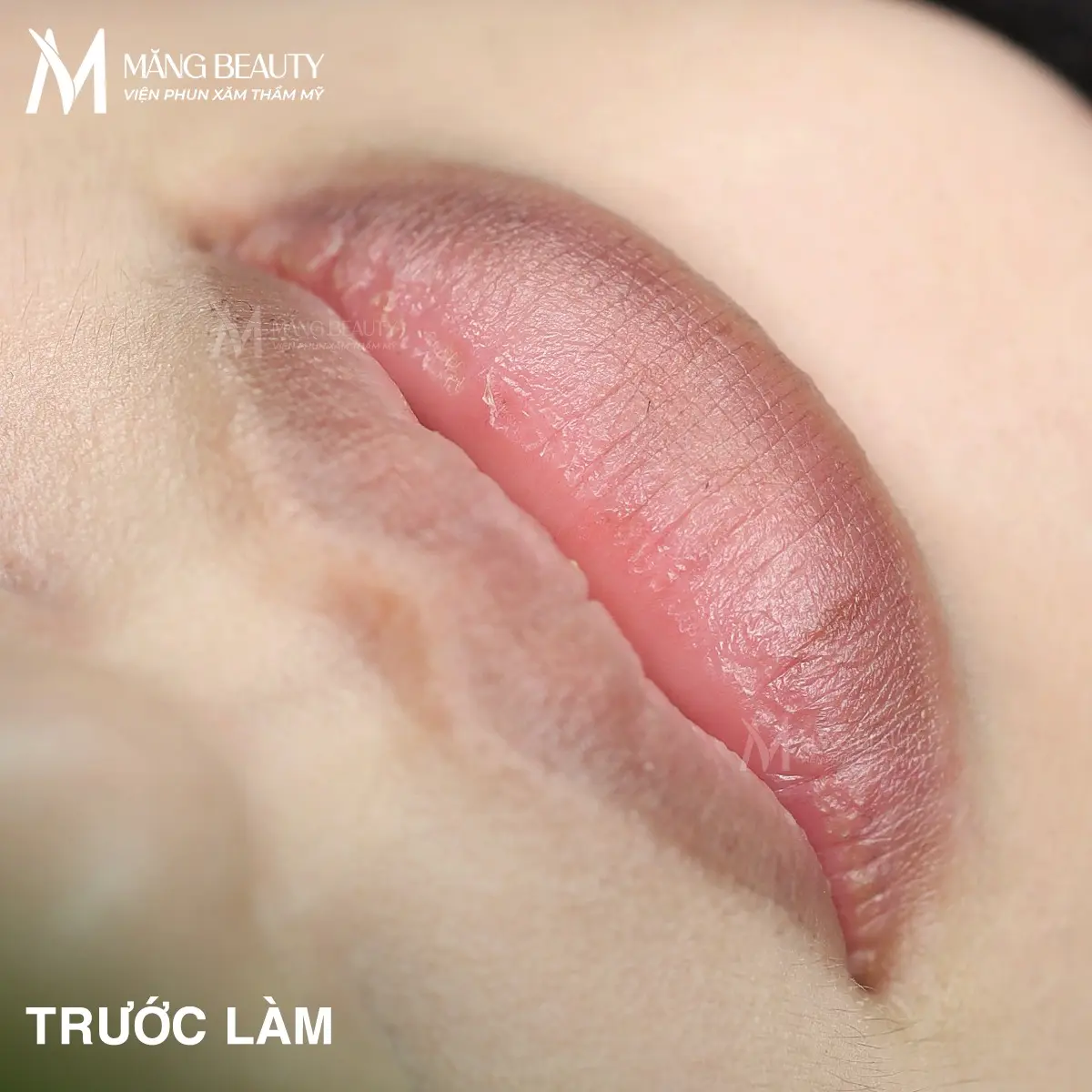 Ưu điểm