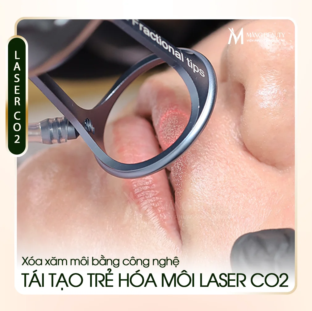 Xóa xăm môi bằng Laser CO2 - Giải pháp an toàn cho môi phun hỏng
