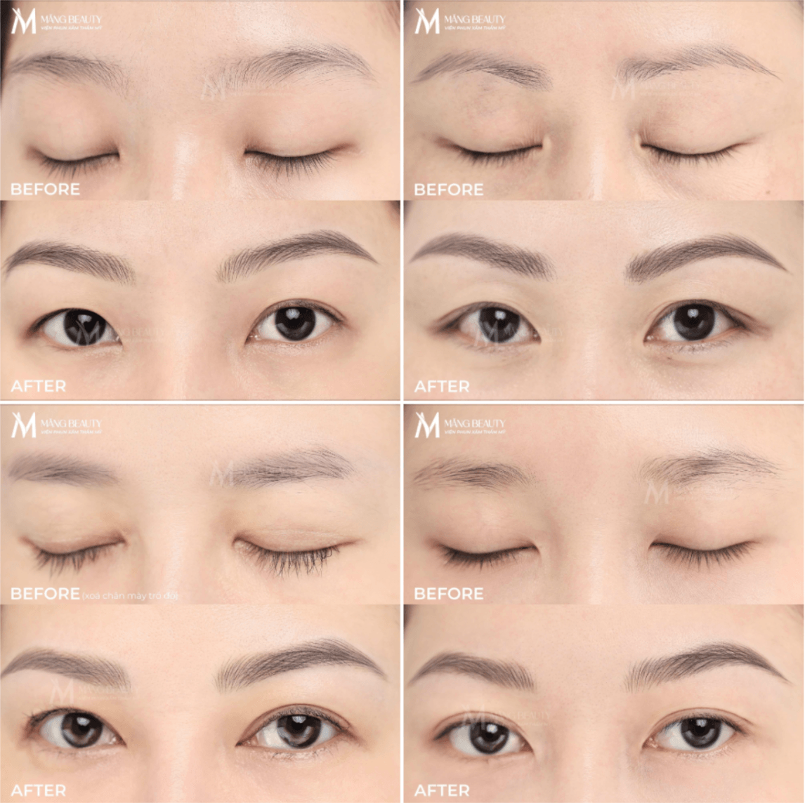 Hình ảnh thực tế khách hàng trước và sau khi làm chân mày tại Măng Beauty