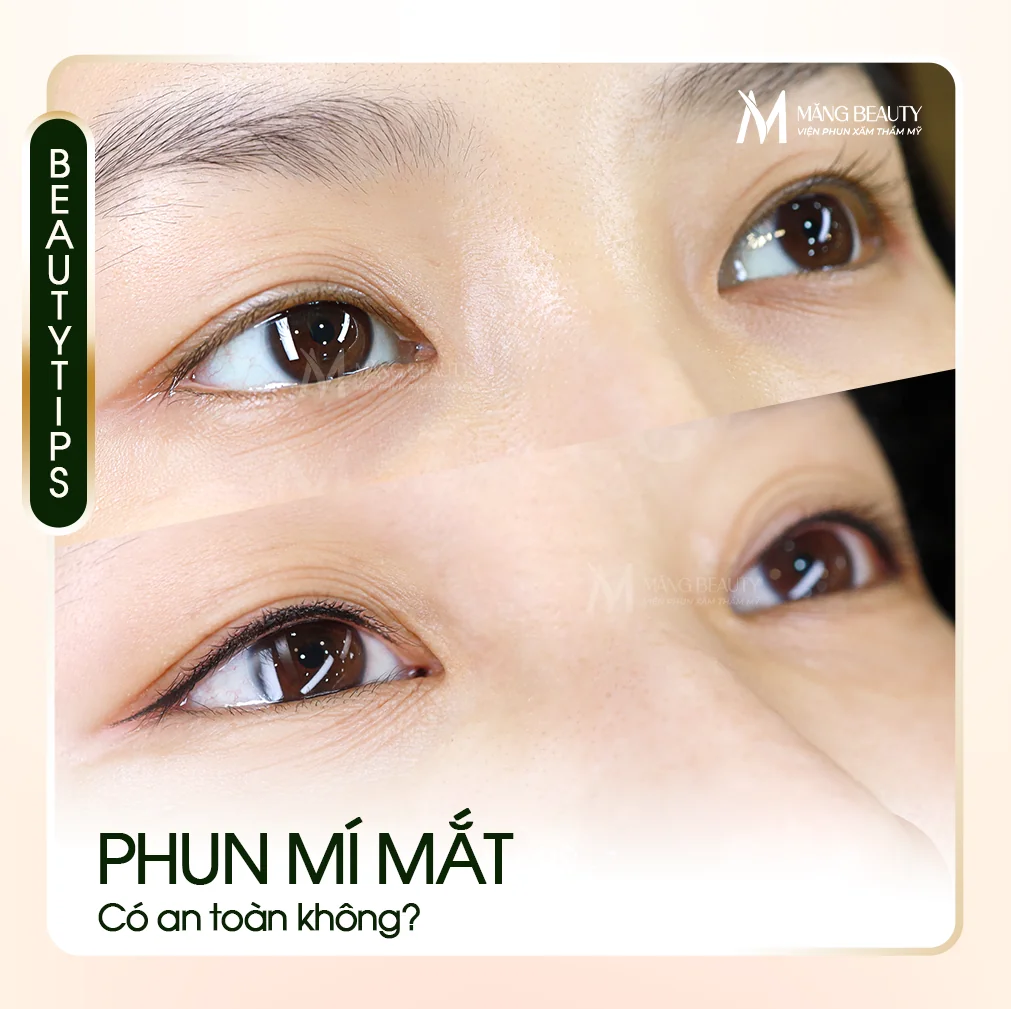 Phun Mí Mắt Có An Toàn Không?