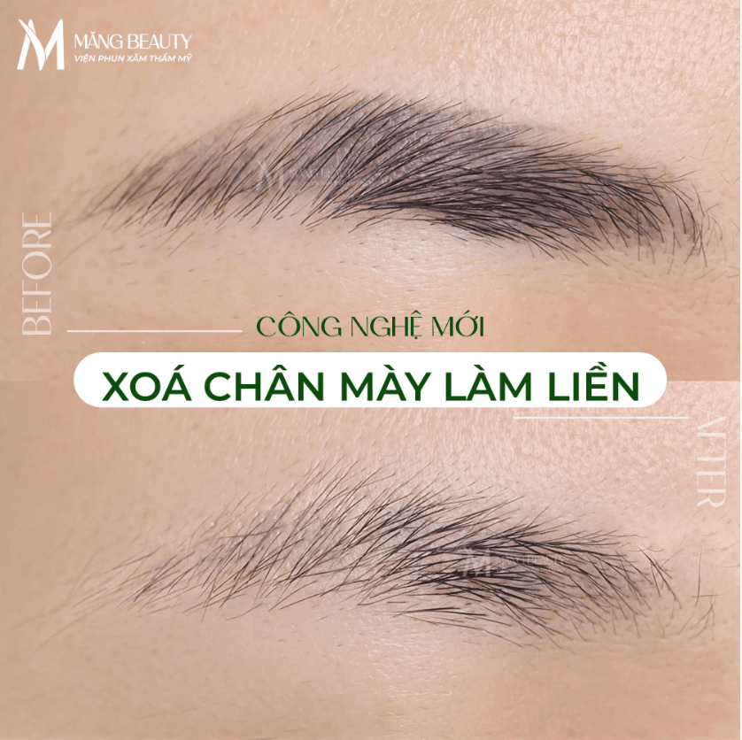 Chân mày cũ vẫn có thể xóa và làm mới ngay trong 1 buổi