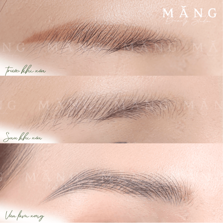 Măng Beauty - Địa chỉ xoá sửa chân mày uy tín tại TP.HCM 