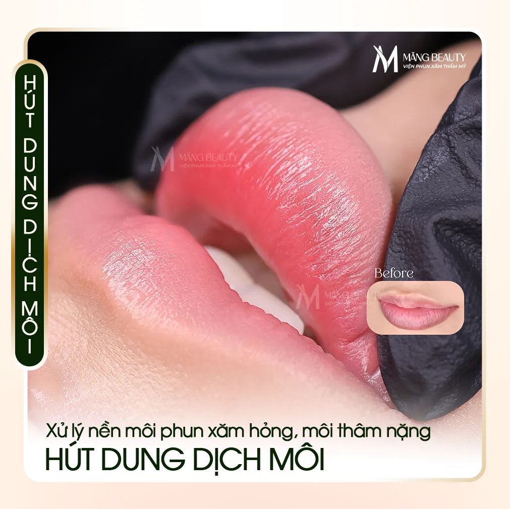 Hút dung dịch môi tại Măng Beauty - Giải pháp xử lý nền môi phun xăm hỏng, môi thâm nặng