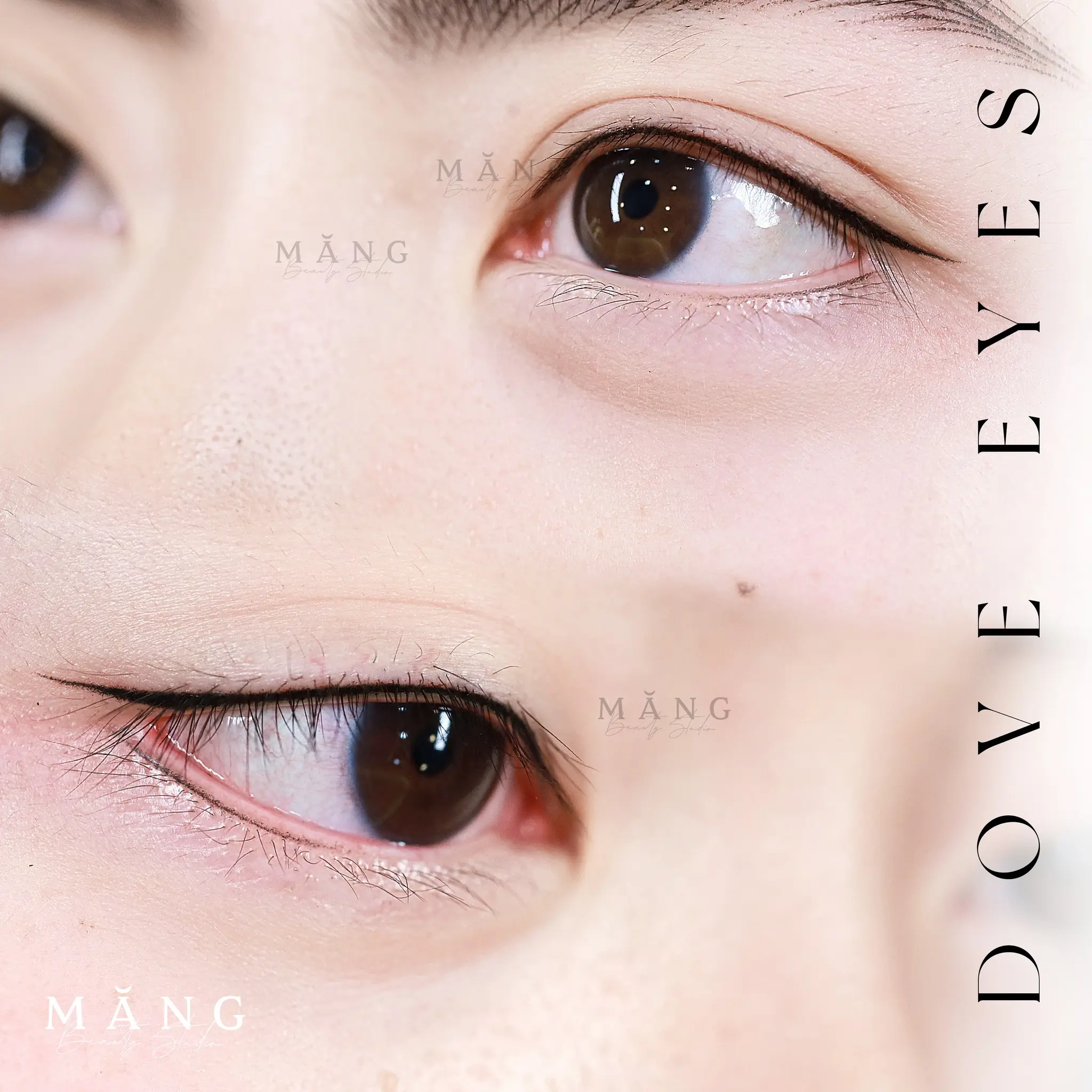 Phun mí tại Măng Beauty an toàn, kết qủa thẩm mỹ cao