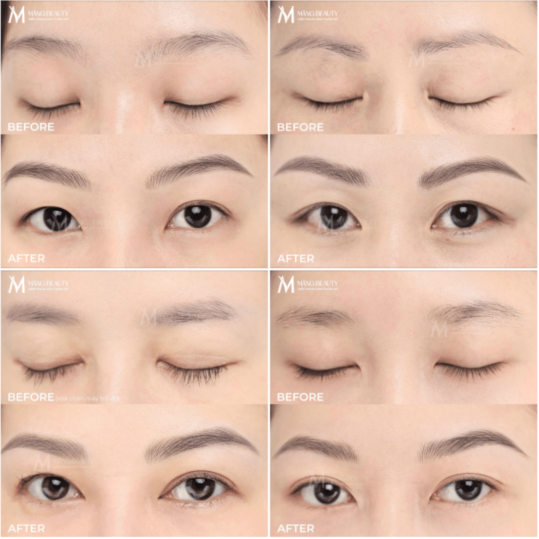 Hình ảnh khách hàng trước và sau khi phun chân mày tại Măng Beauty 