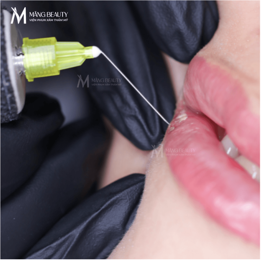 Plasma môi tác động vi điểm lên bề mặt môi giúp nền môi khỏe và đều màu hơn