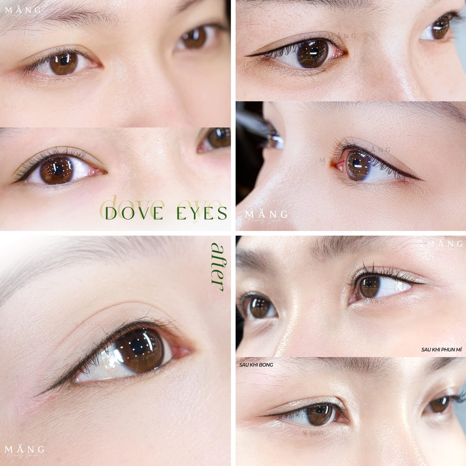 Hình ảnh thực tế khách hàng sau phun mí đá đuôi tại Măng Beauty