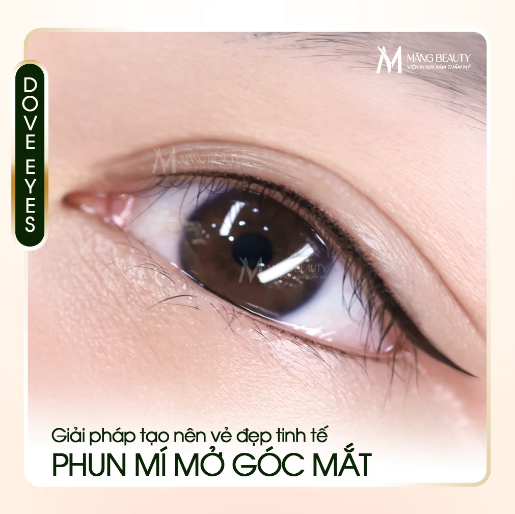Phun mí mở góc mắt là gì? Giải pháp “mở rộng” vẻ đẹp tinh tế cho đôi mắt tại Măng Beauty
