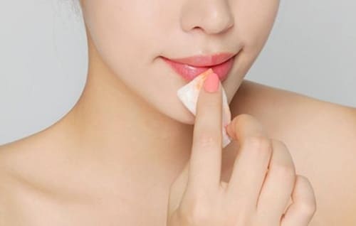 Hướng dẫn chăm sóc sau khi khử thâm môi để kết quả bền đẹp