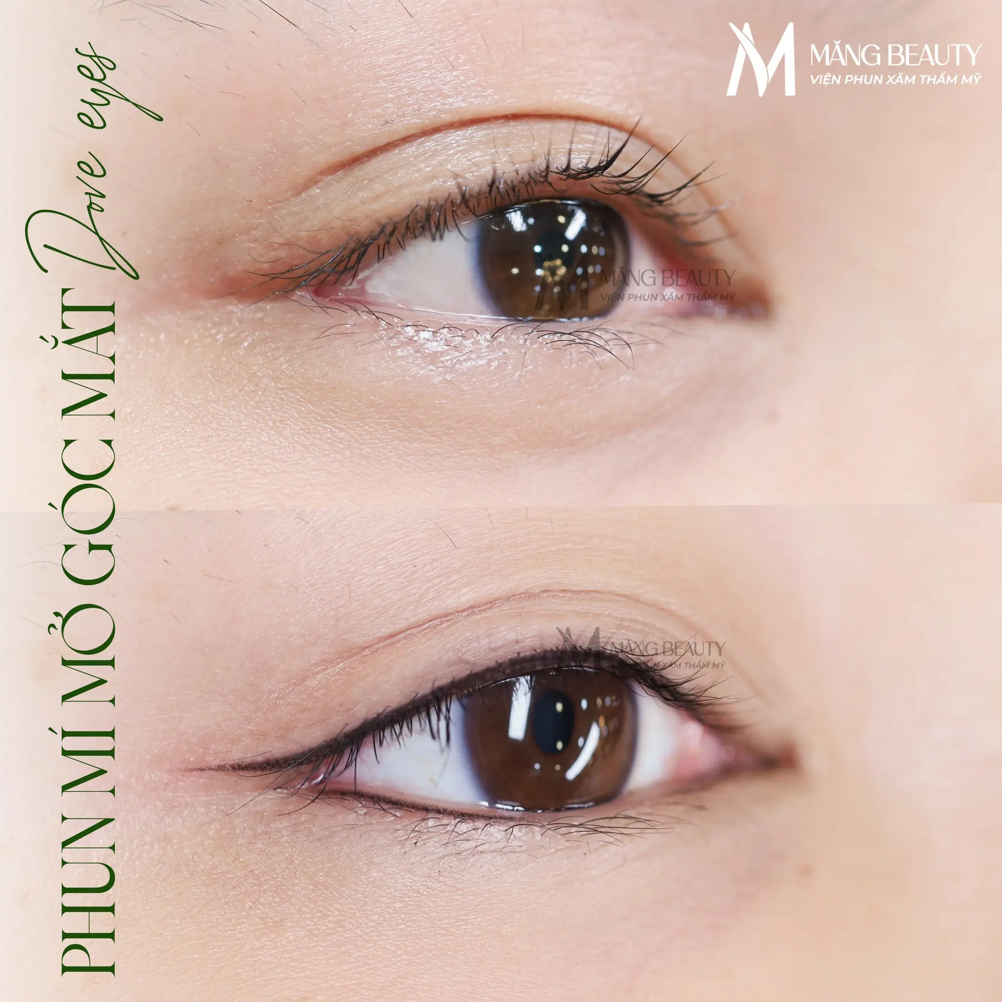 Phun mí mở góc mắt được nhiều khách hàng ưa chuộng tại Măng Beauty